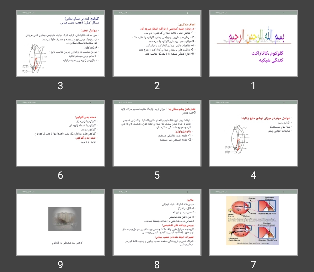 پاورپوینت گلوکوم، کاتاراکت و کندگی شبکیه