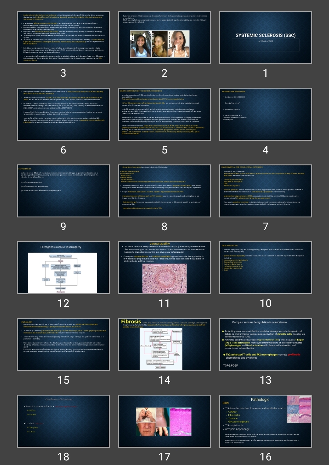 پاورپوینت Systemic sclerosis (SSc)