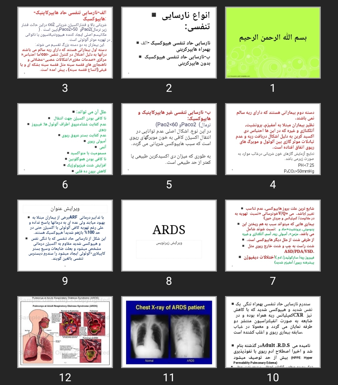 پاورپوینت ARDS