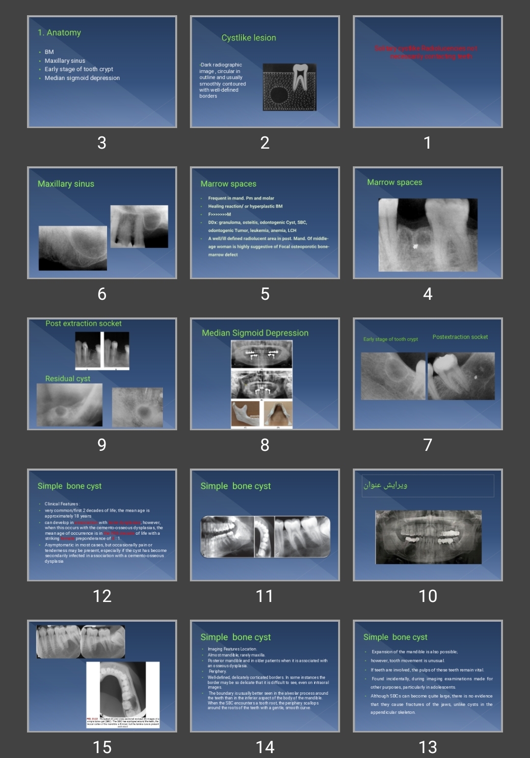 پاورپوینت Solitary cystlike Radiolucencies not necessarily contacting teeth