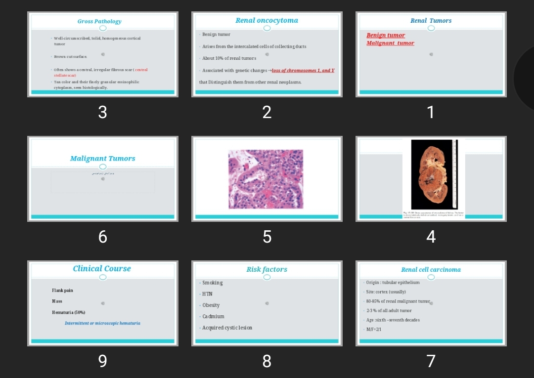 پاورپوینت Renal Tumors