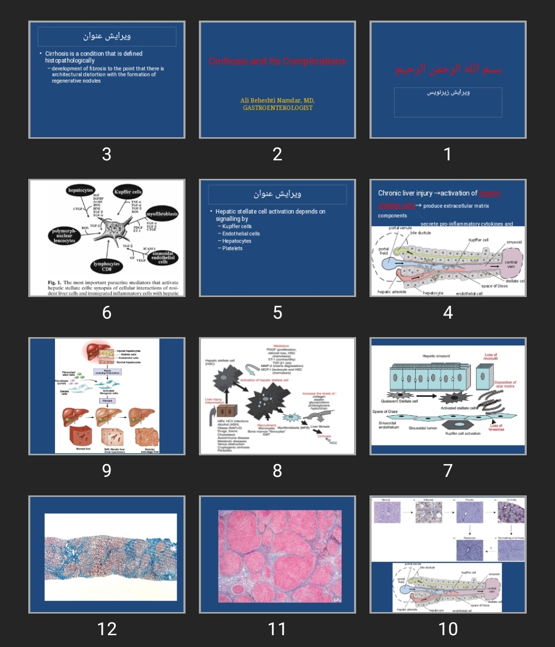 پاورپوینت Cirrhosis and Its Complications