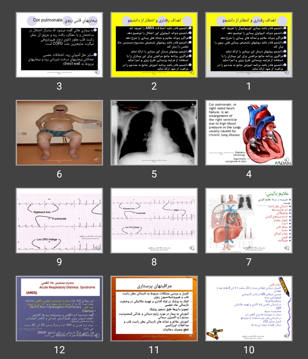 پاورپوینت Respiratory Diseases-Corpulmonale and ARDS