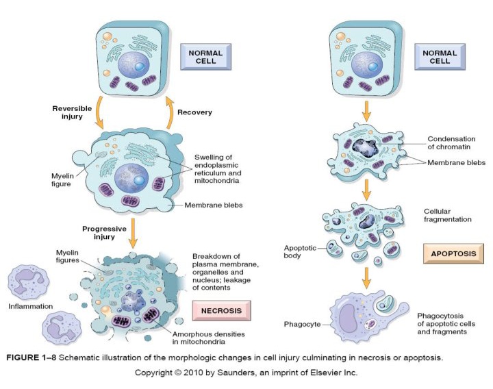 جزوه cellular injury necrosis , apoptosis - زبان انگلیسی - ۵۰ صفحه