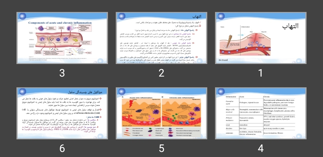 پاورپوینت التهاب