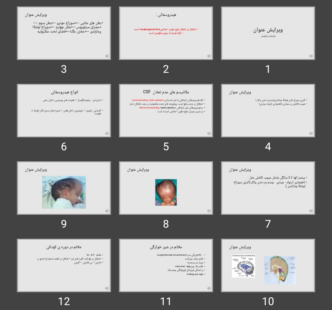 پاورپوینت هیدروسفالی