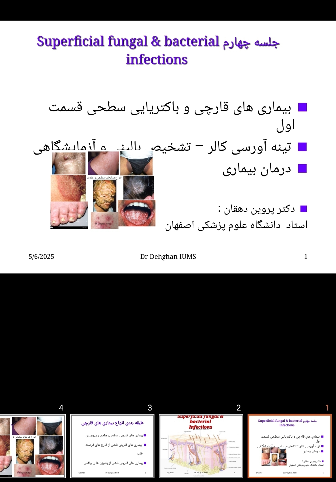 پاورپوینت بیماری های قارچی سطحی، تینه آ ورسی کالر، تریکوباکتریوزیس آگزیلارس، اریتراسما