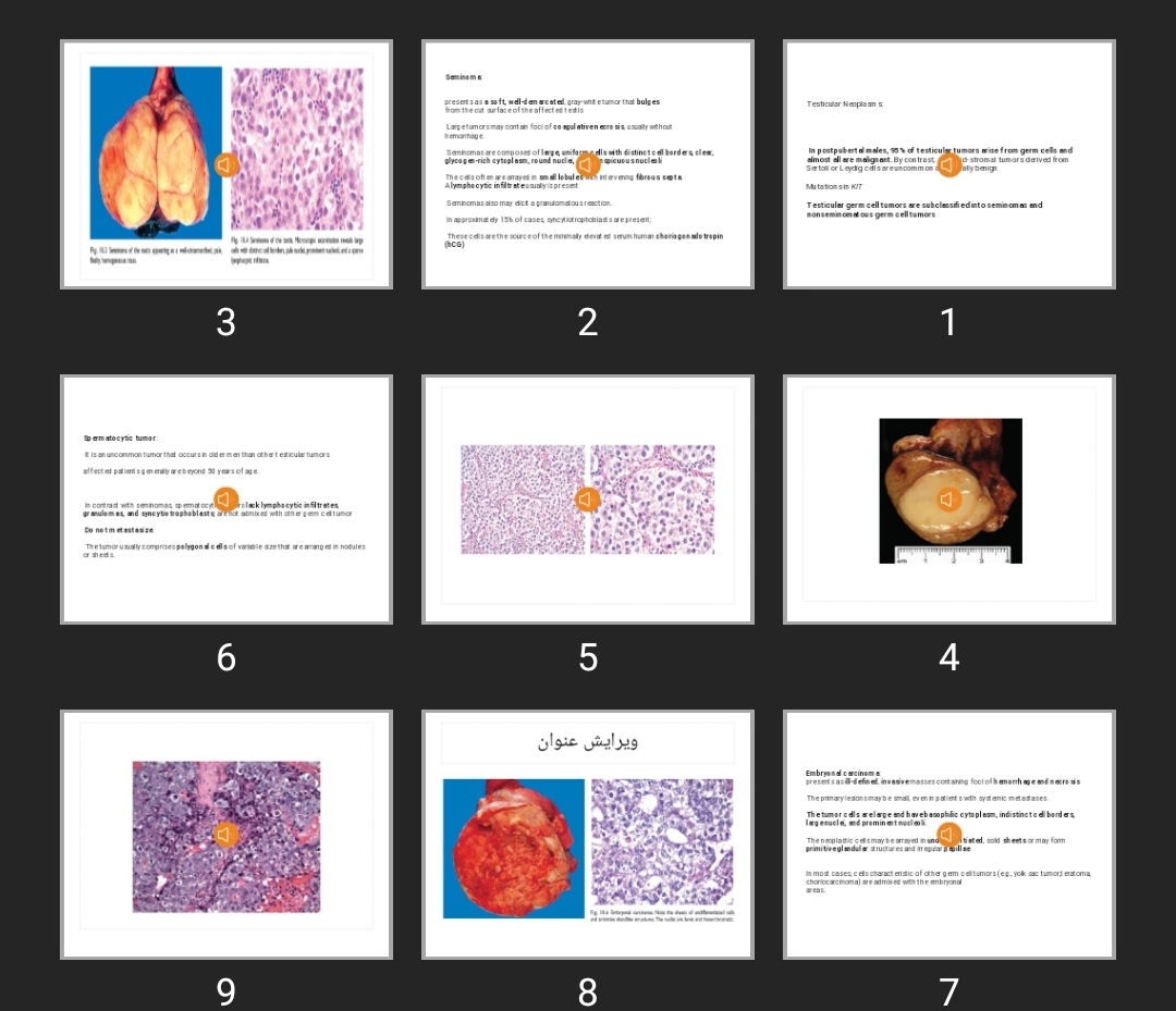 پاورپوینت main lesions of male genital tractVOICE2