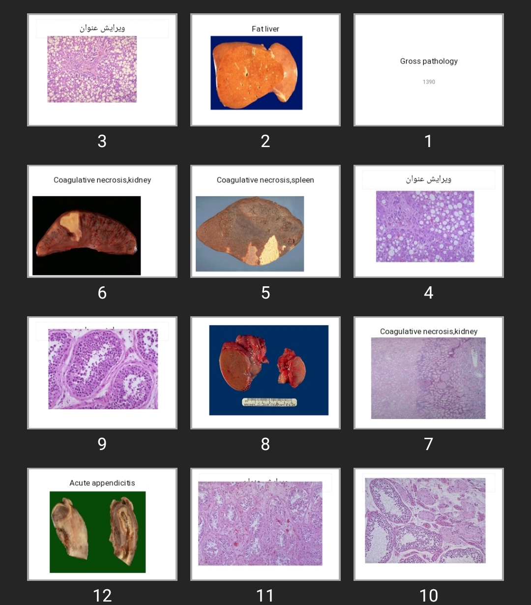 پاورپوینت Gross pathology