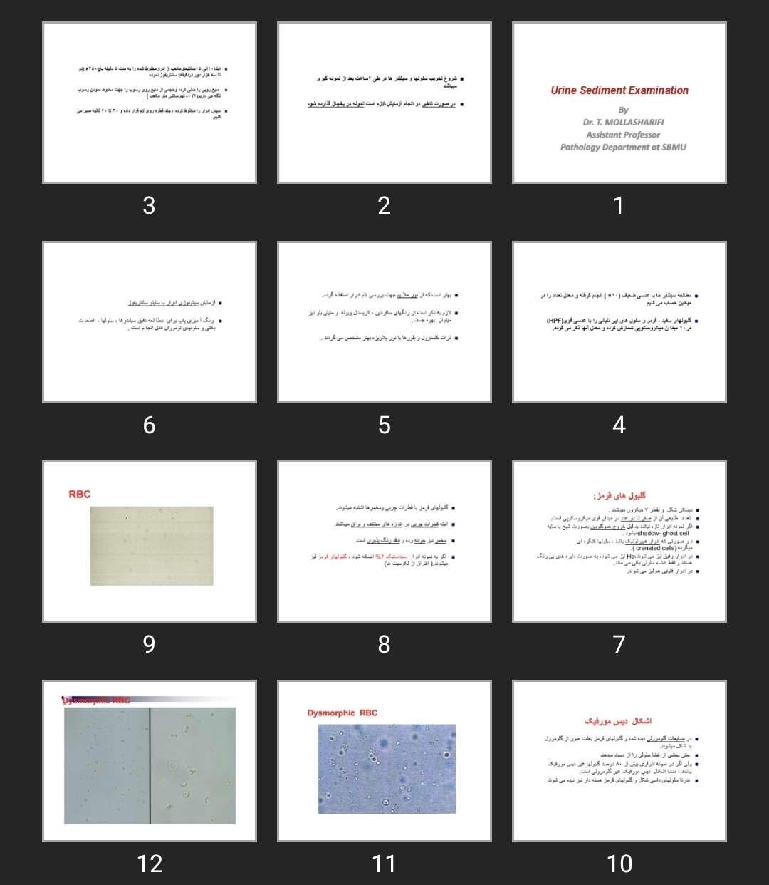 پاورپوینت Urine Sediment Examination