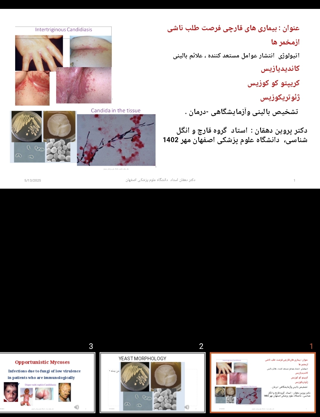 پاورپوینت بیماری های قارچی فرصت طلب ناشی ازمخمر ها