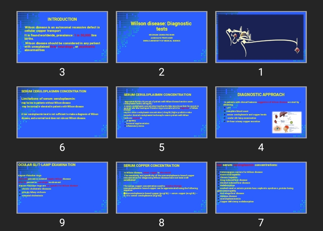 پاورپوینت Wilson disease: Diagnostic tests