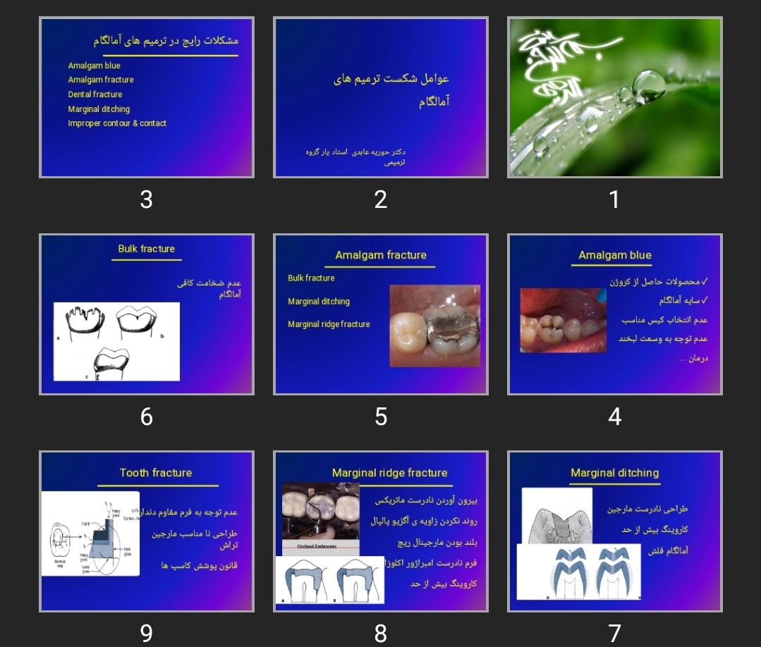 پاورپوینت عوامل شکست ترمیم های آمالگام