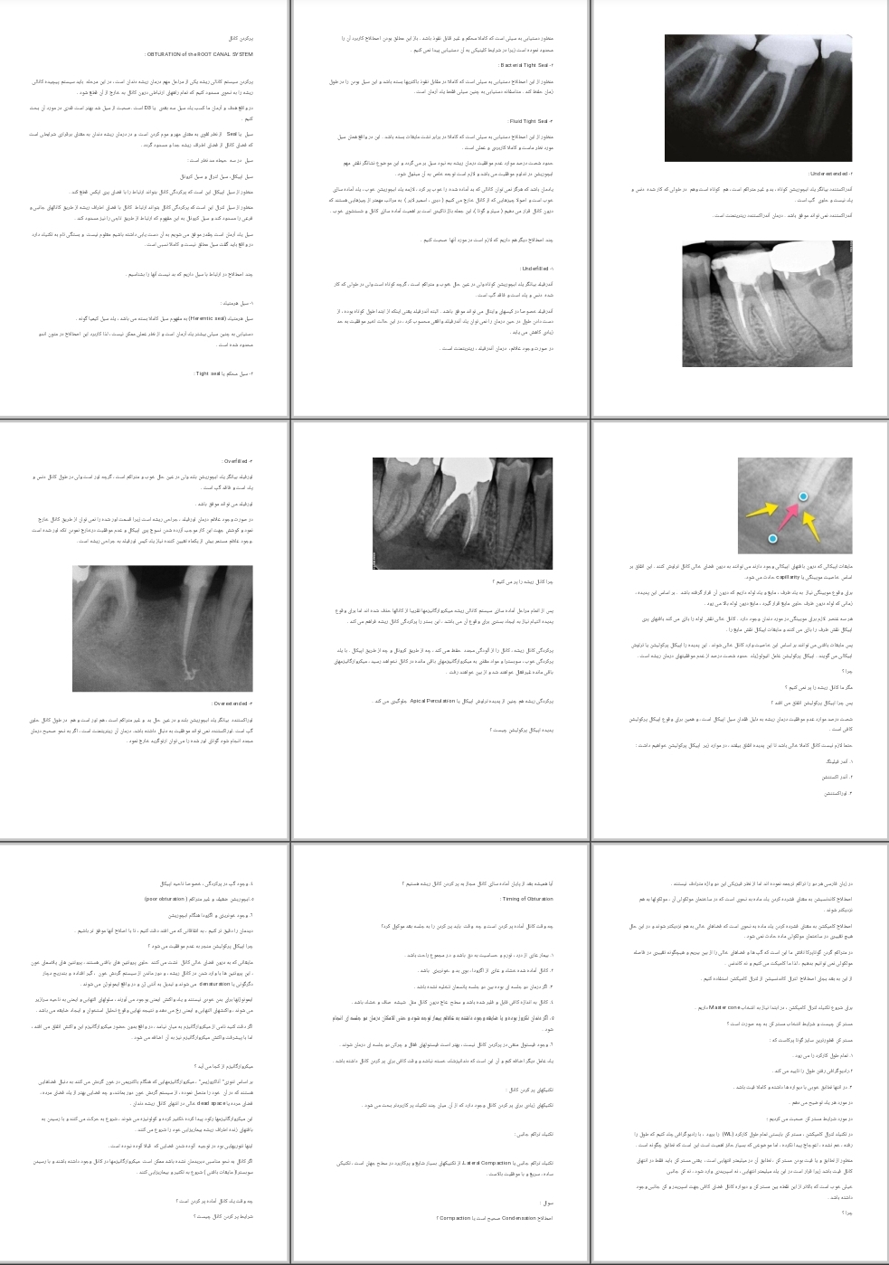 جزوه پركردن كانال  OBTURATION of the ROOT CANAL SYSTEM