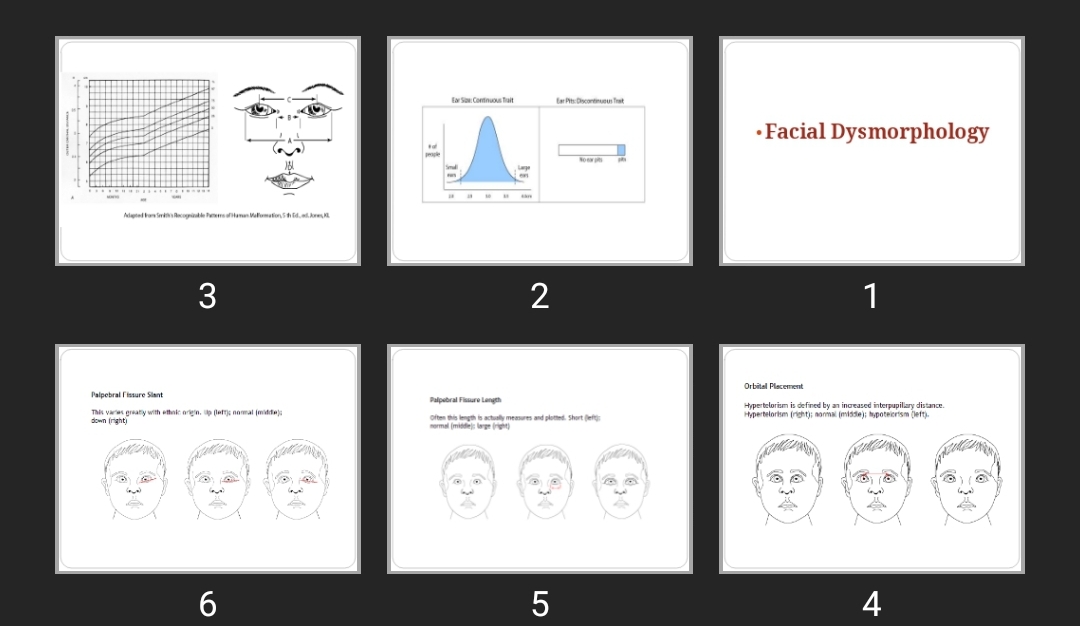 پاورپوینت Facial Dysmorphology