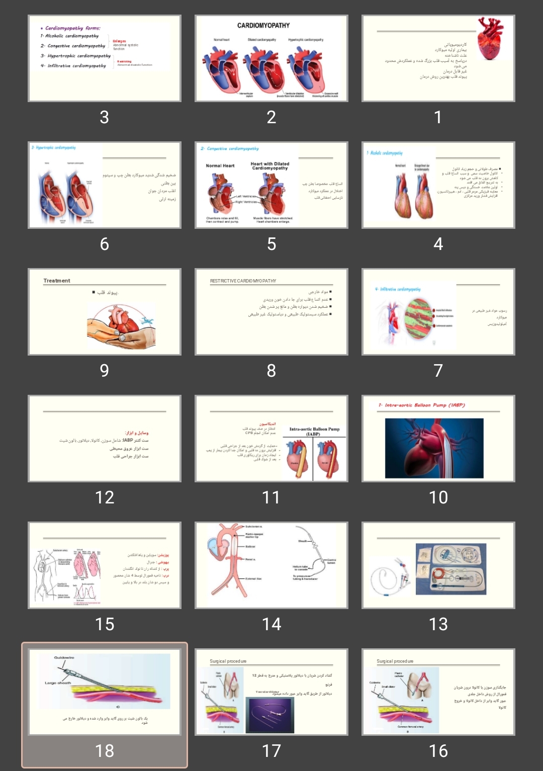 پاورپوینت Ventricular Aneurysm و اختلال دریچه