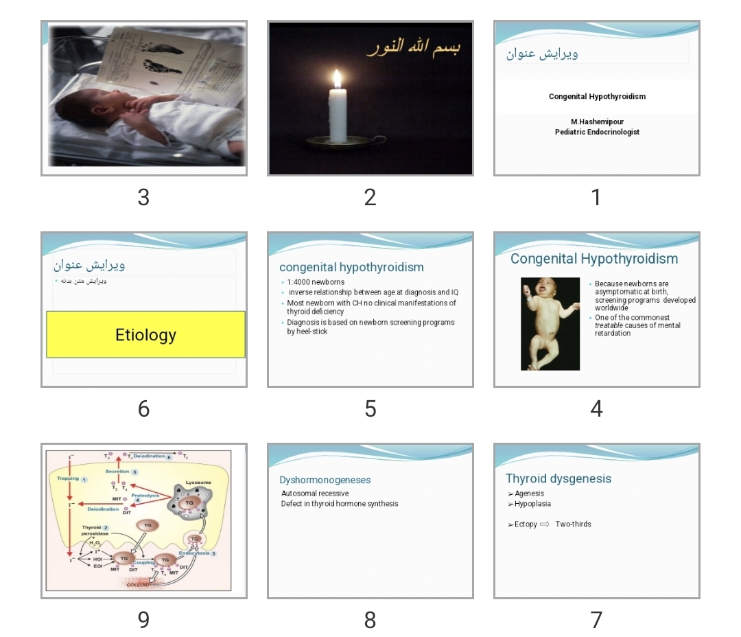 پاورپوینت Congenital Hypothyroidism
