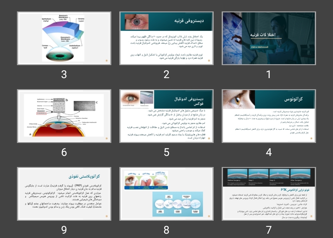 پاورپوینت اختلالات قرنیه