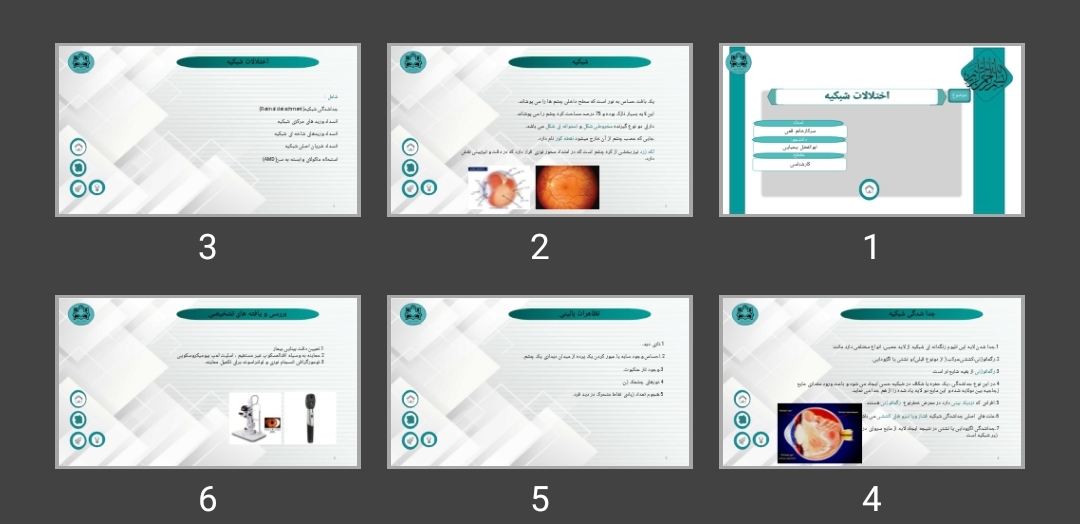 پاورپوینت اختلالات شبکیه