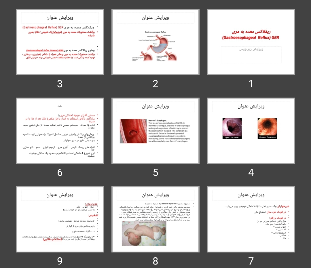 پاورپوینت ریفلاکس معده به مری