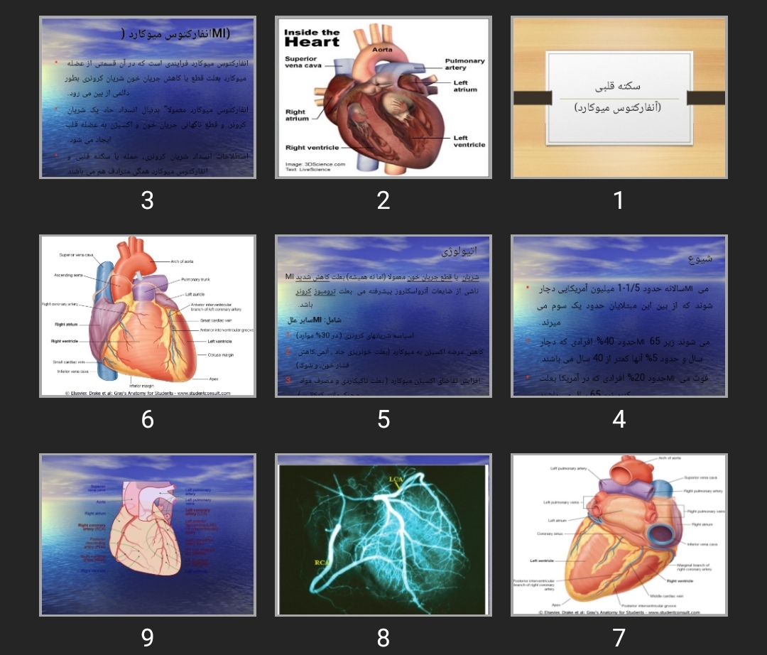 پاورپوینت سکته قلبی (آنفارکتوس میوکارد)