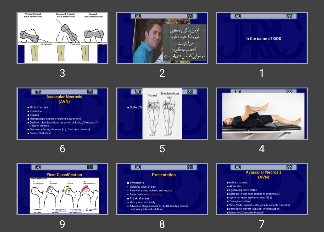 پاورپوینت Hip Disorders