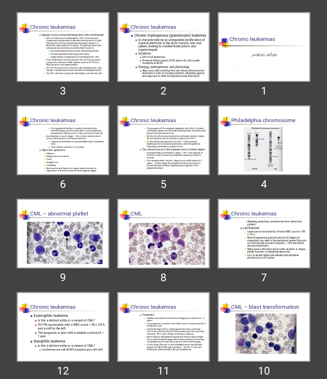 پاورپوینت لوسمی مزمن Chronic leukemias