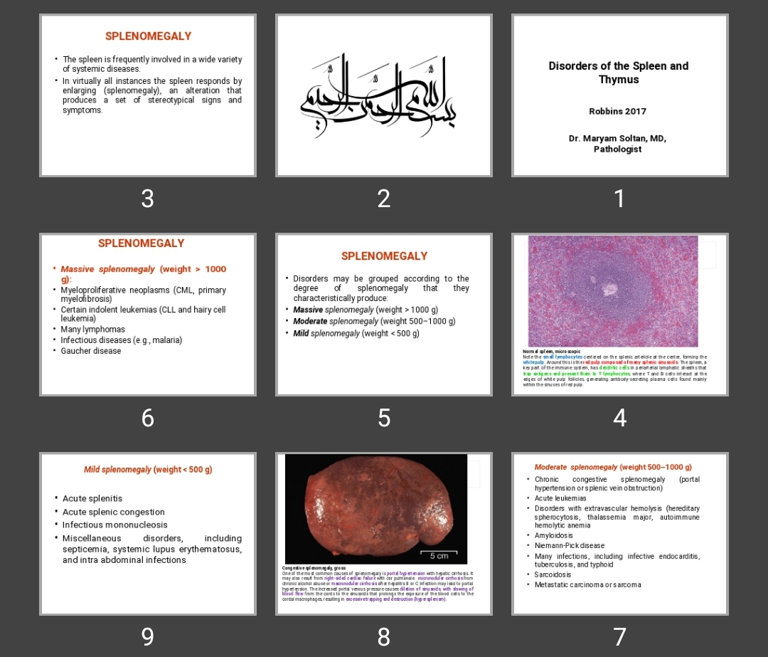 پاورپوینت Disorders of the Spleen and Thymus