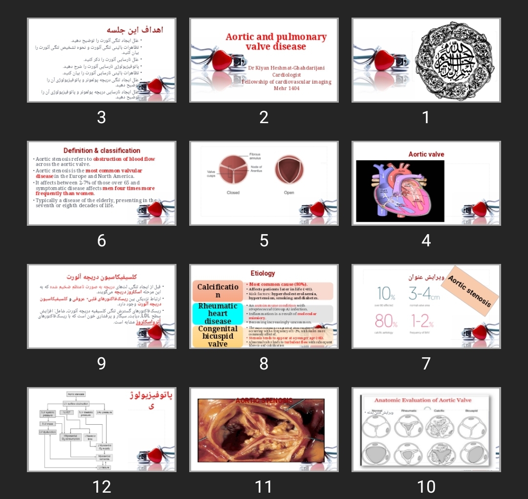 پاورپوینت Aortic and pulmonary valve disease