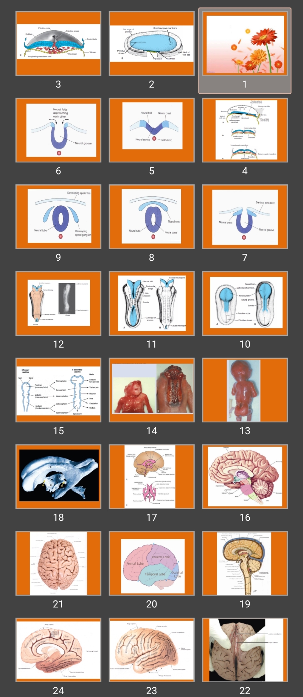 پاورپوینت neuro