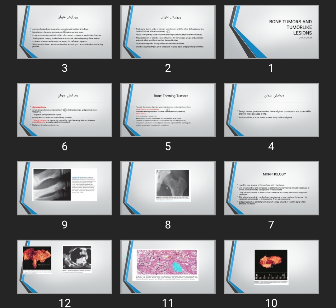 پاورپوینت BONE TUMORS AND TUMORLIKE LESIONS