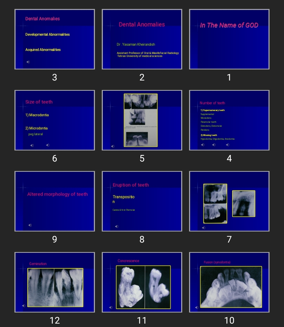پاورپوینت Dental Anomalies