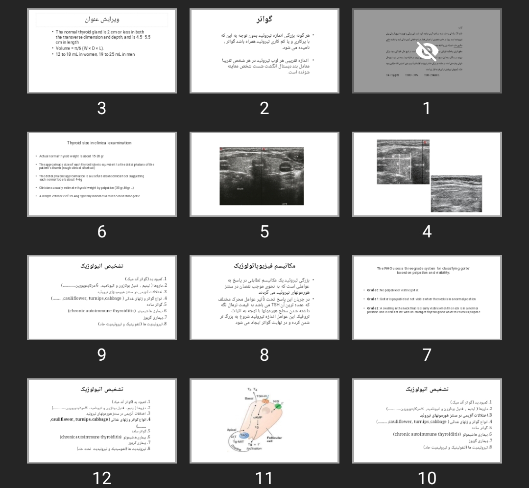 پاورپوینت Goiter گواتر