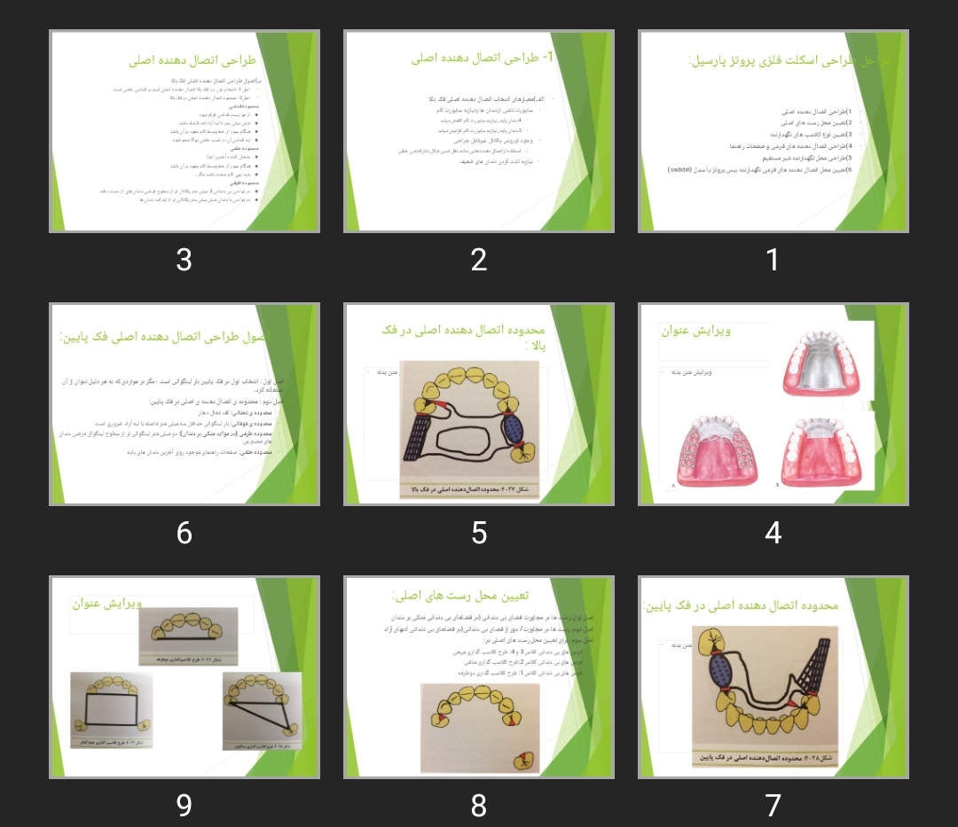 پاورپوینت مراحل طراحی اسکلت فلزی پروتز پارسیل