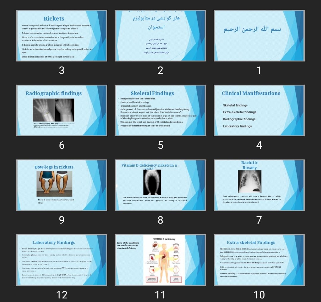 پاورپوینت ریکتز در کودکان و تاثیر بیماری های گوارشی در متابولیزم استخوان