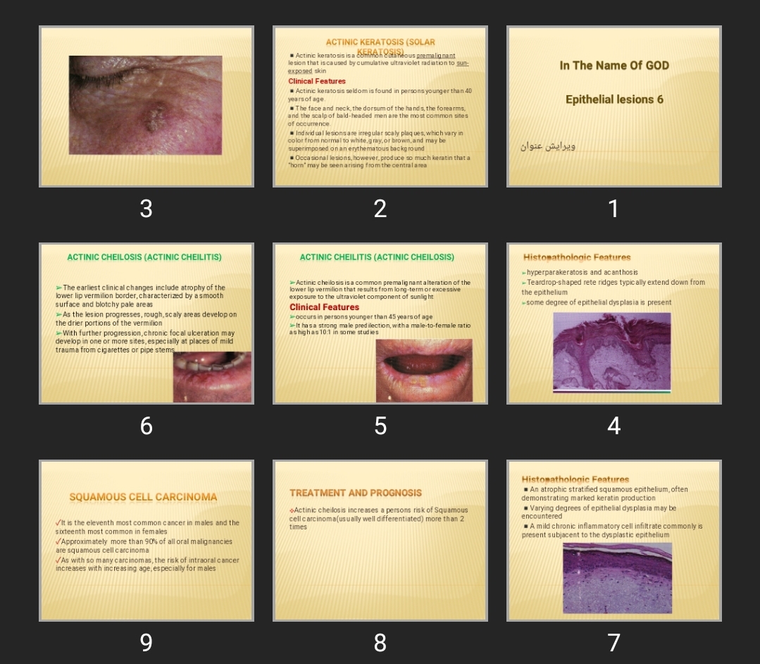 پاورپوینت Epithelial lesions 6