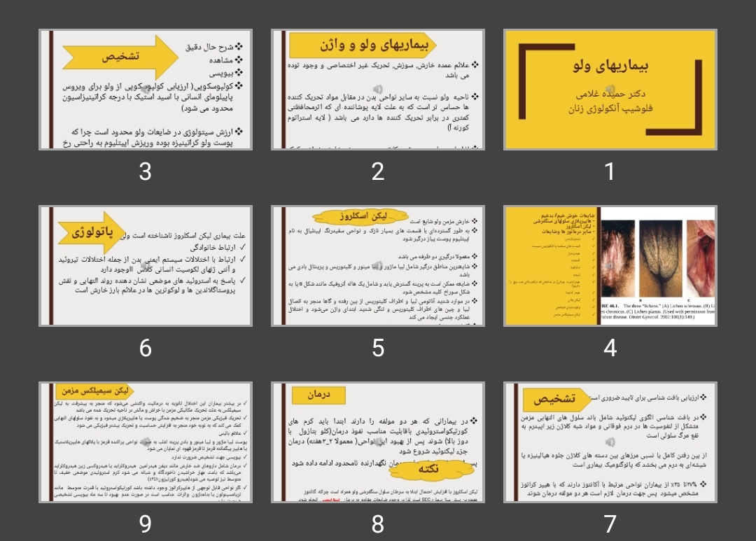 پاورپوینت بیماری های ولو