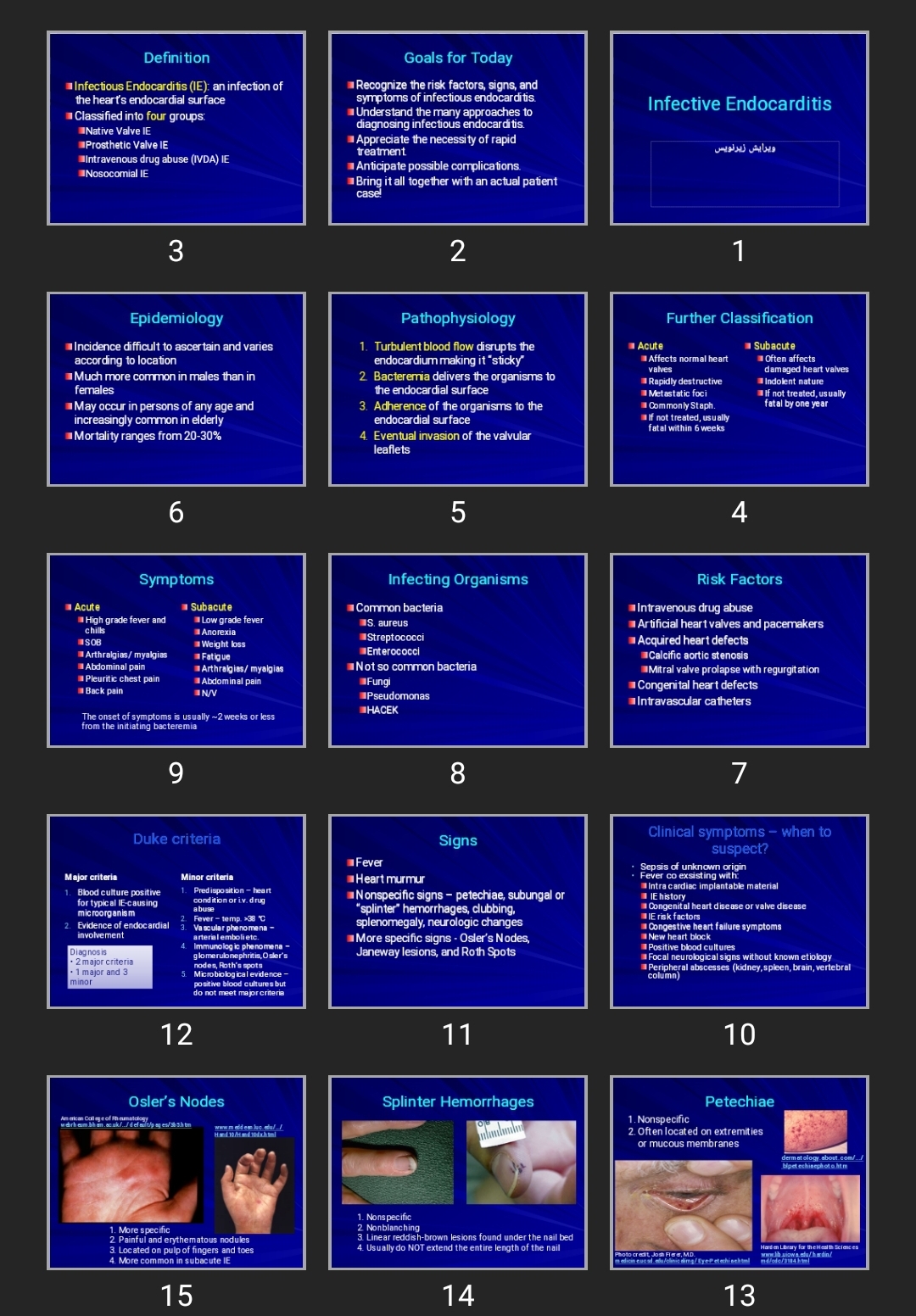 پاورپوینت Infective Endocarditis