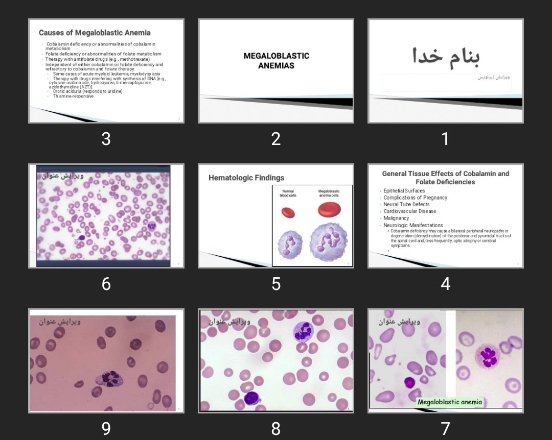 پاورپوینت MEGALOBLASTIC ANEMIAS
