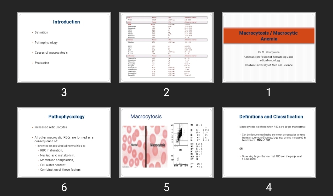 پاورپوینت آنمی ماکروسیتیک Macrocytosis / Macrocytic Anemia