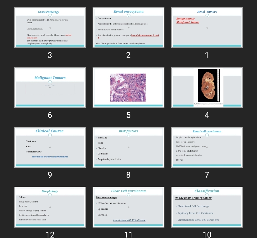 پاورپوینت Renal Tumors