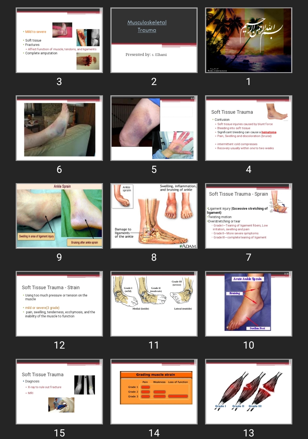 پاورپوینت Musculoskeletal trauma