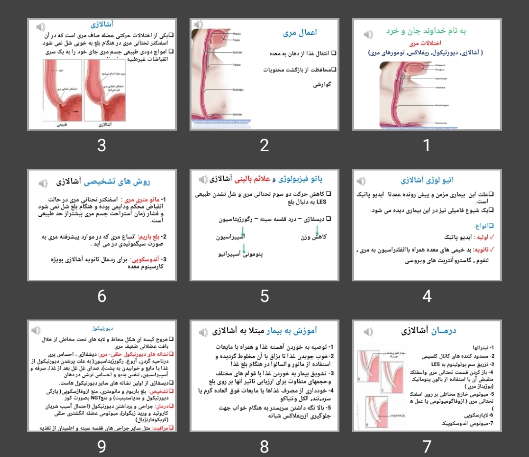 پاورپوینت اختلالات مری (آشالازی، دیورتیکول، ریفلاکس، تومورهای مری)