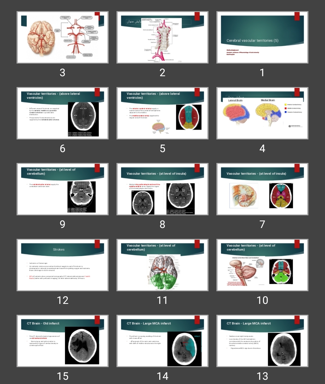 پاورپوینت سکته مغزی و خونرسانی مغز Cerebral vascular territories