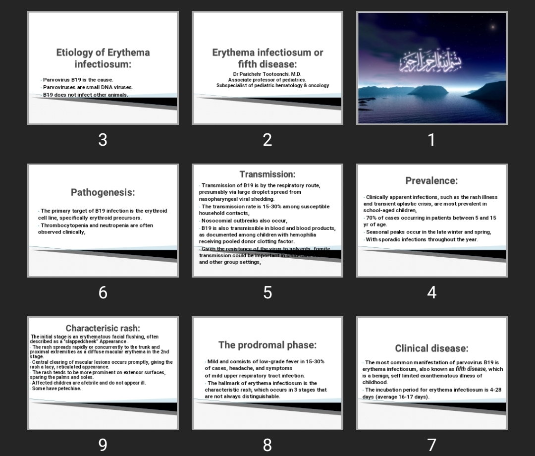 پاورپوینت Erythema infectiosum or fifth disease