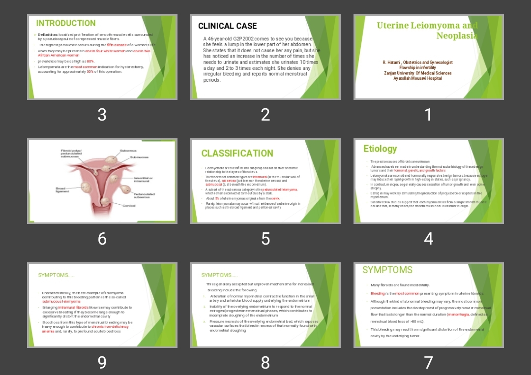 پاورپوینت Uterine Leiomyoma and Neoplasia