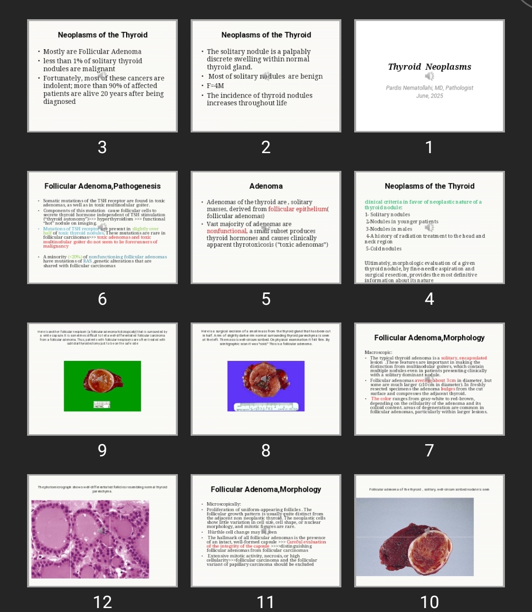 پاورپوینت Thyroid Neoplasms