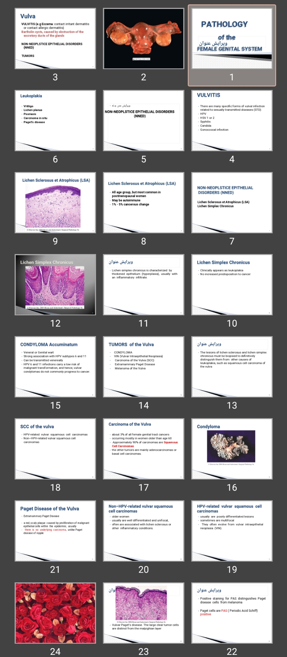 پاورپوینت پاتولوژی زنان  PATHOLOGY of the FEMALE GENITAL SYSTEM