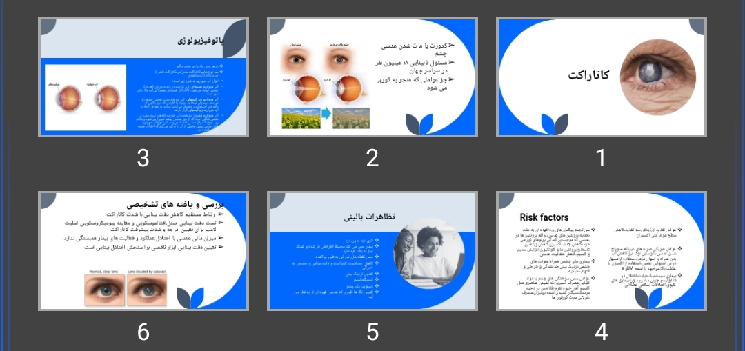 پاورپوینت کاتاراکت