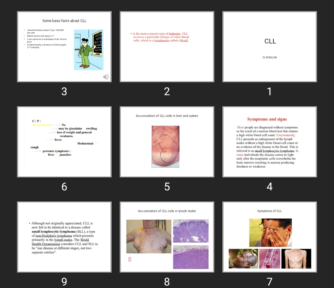پاورپوینت CLL